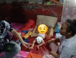 BAYI PENDERITA HIDROSEFALUS DI SUBANG KESULITAN BIAYA BEROBAT KE RSHS BANDUNG